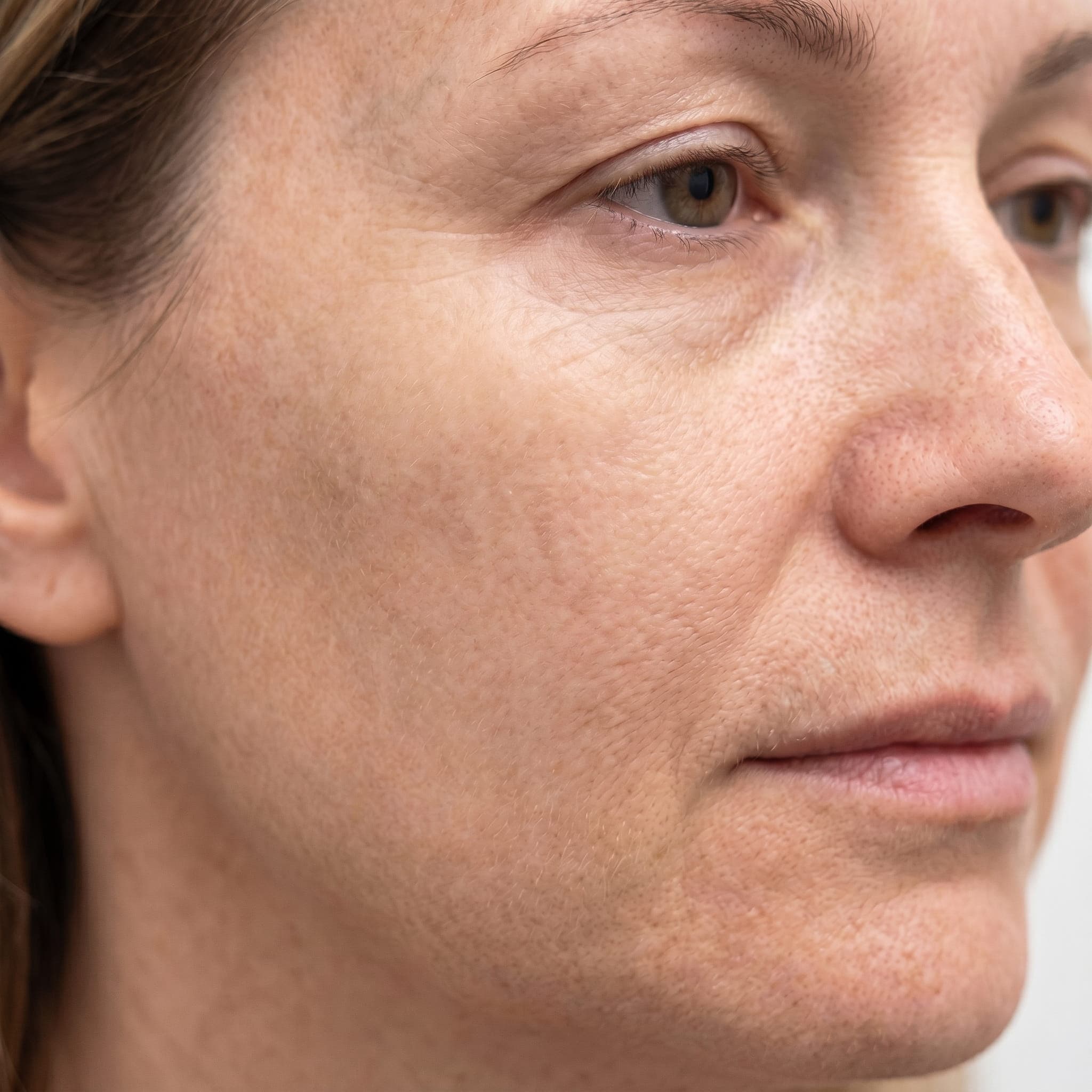 After